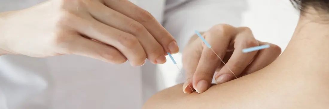 Acupuncture: how can it help during and after pregnancy?